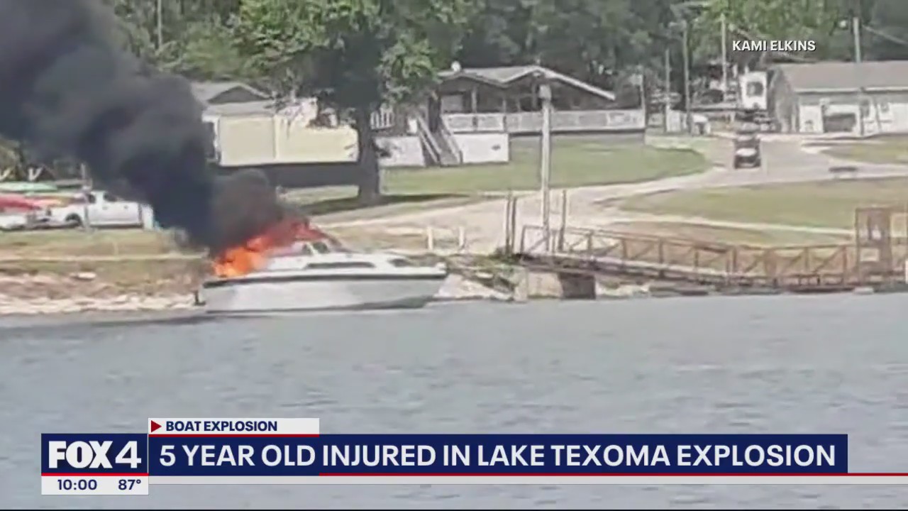 5-year-old boy seriously burned in boat explosion