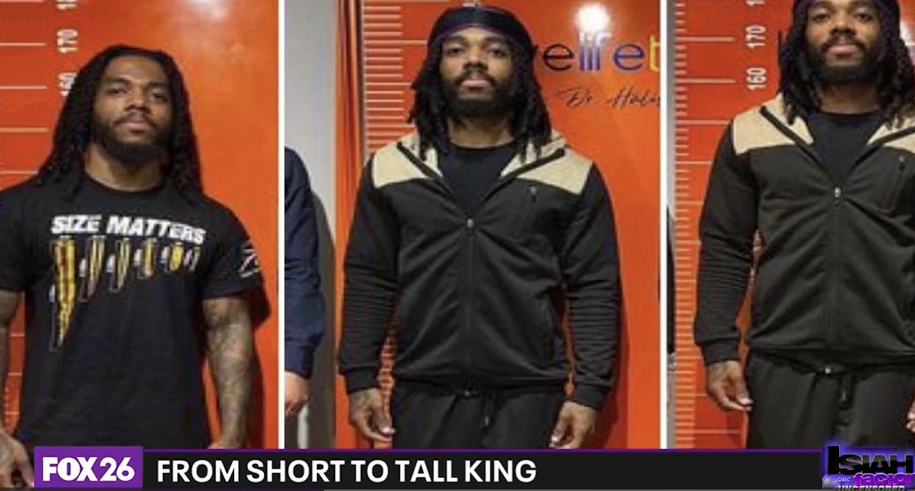 Man receives limb lengthening surgery to go from 5'5" to 6'0"