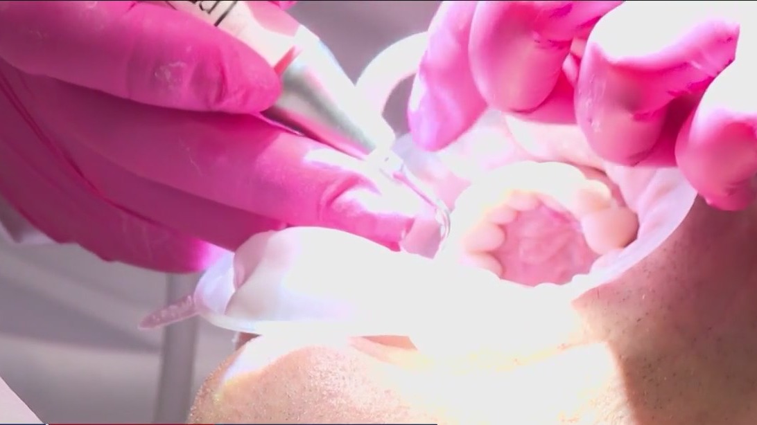 'Airflow' teeth cleaning, less scraping