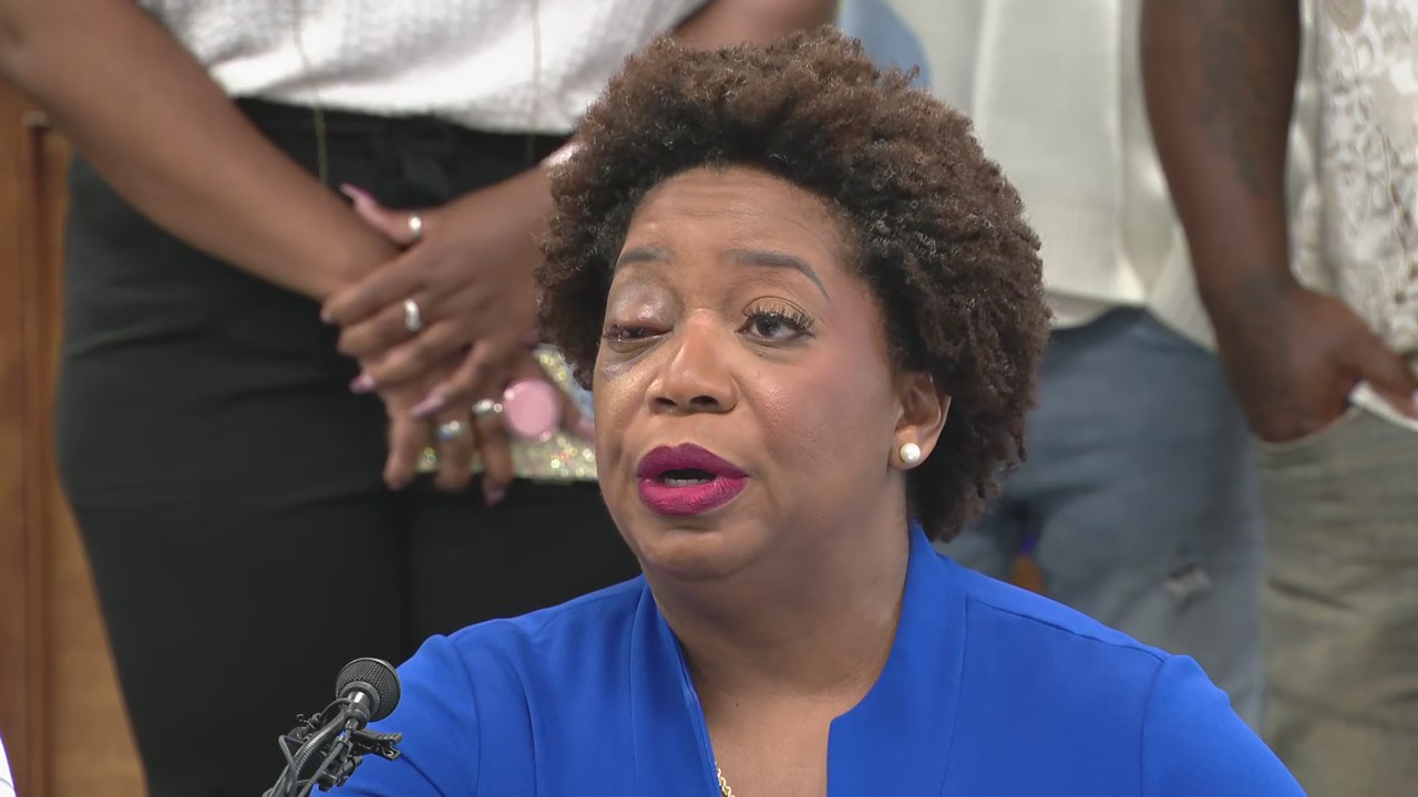 Corsicana administrator has eye knocked out of socket