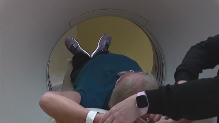 New lung cancer screening guidelines