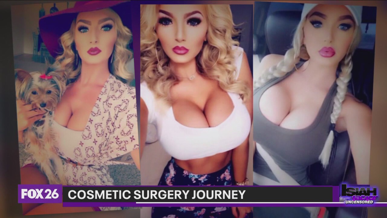 Plastic surgery fans speak out on unwanted attention, harassment