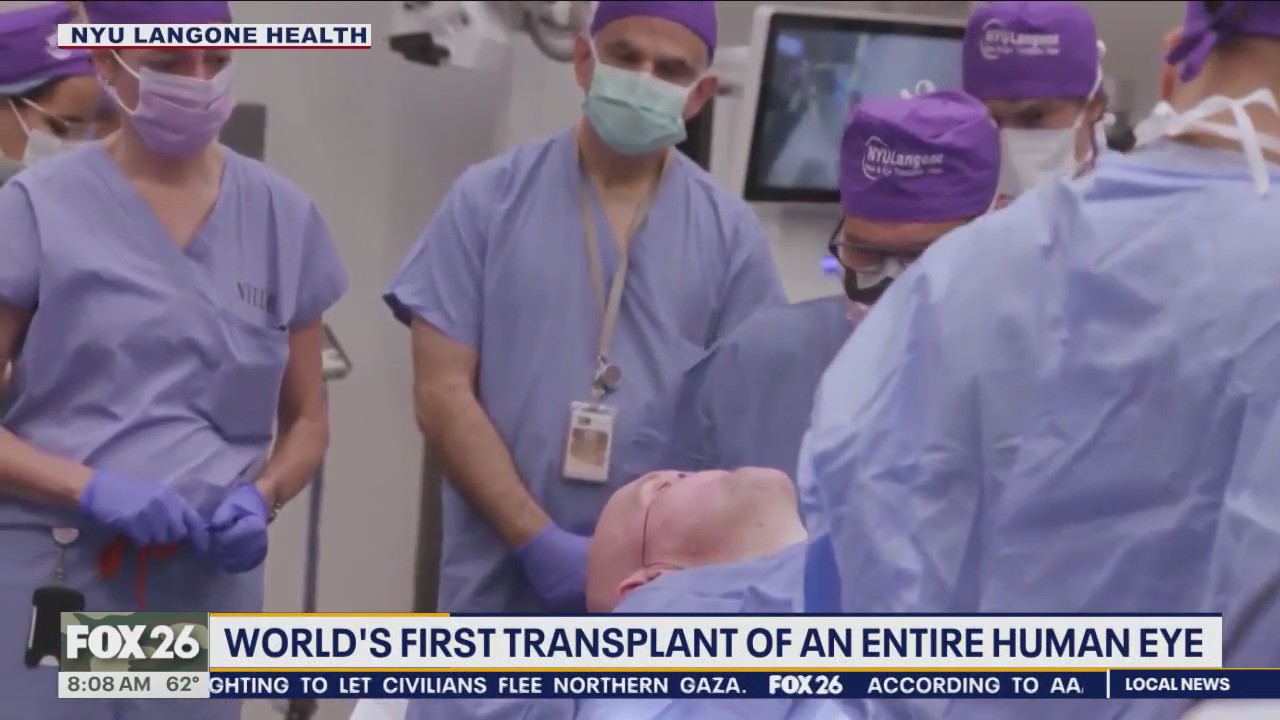 World's 1st transplant of entire human eye