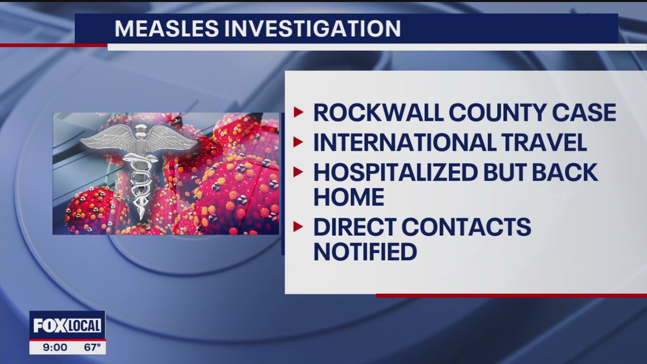 Measles case confirmed in Rockwall County