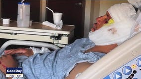 Man hit on way home from buying motorcycle: No helmet