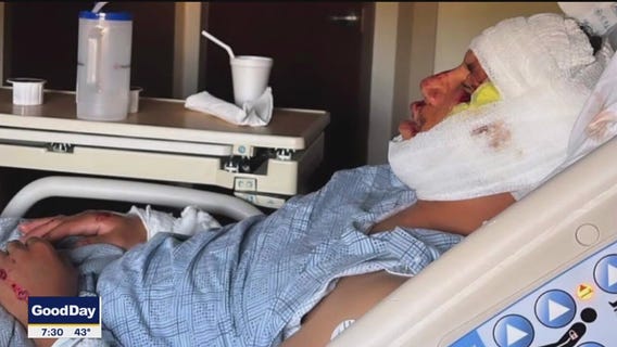 Man hit on way home from buying motorcycle: No helmet