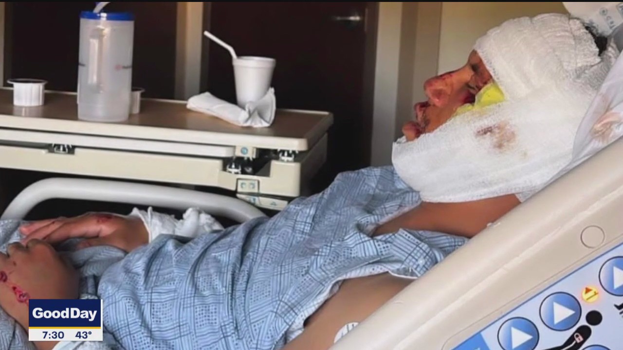 Man hit on way home from buying motorcycle: No helmet