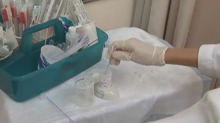Study finds cervical cancer rates rising