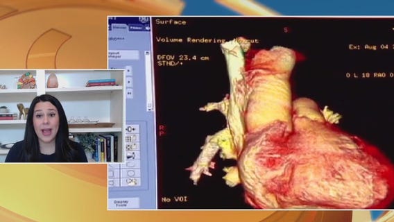 Health links between stress and heart disease