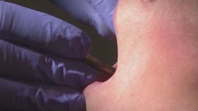 How oral health impacts heart disease risk