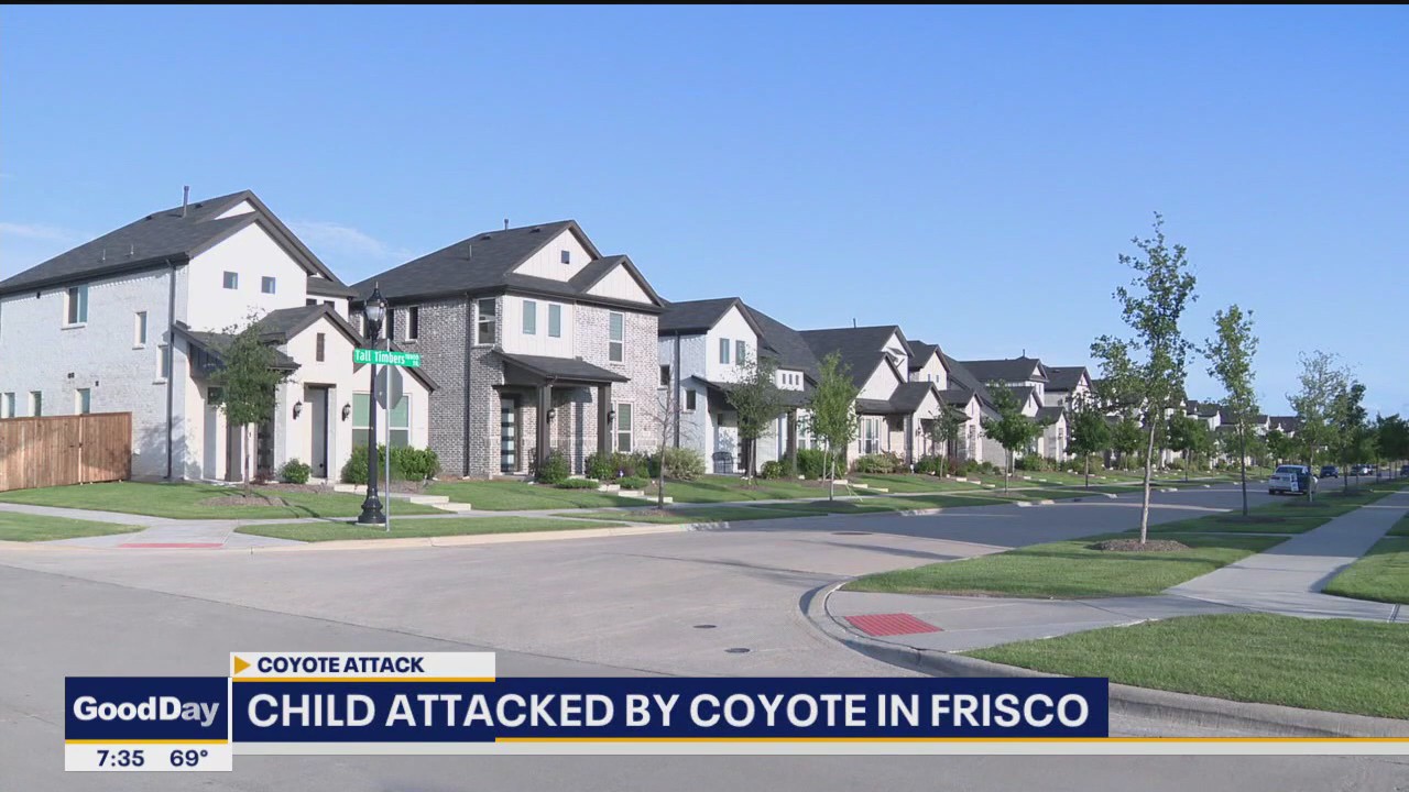 Child attacked by coyote in Frisco neighborhood