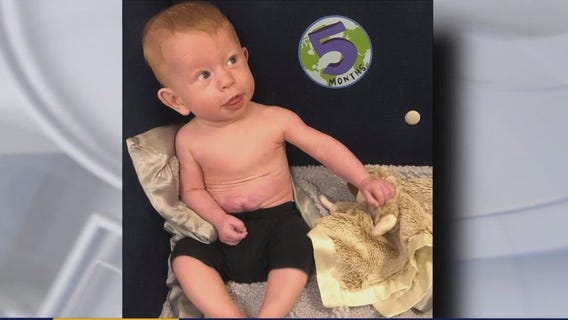 Baby born with organs outside body is thriving