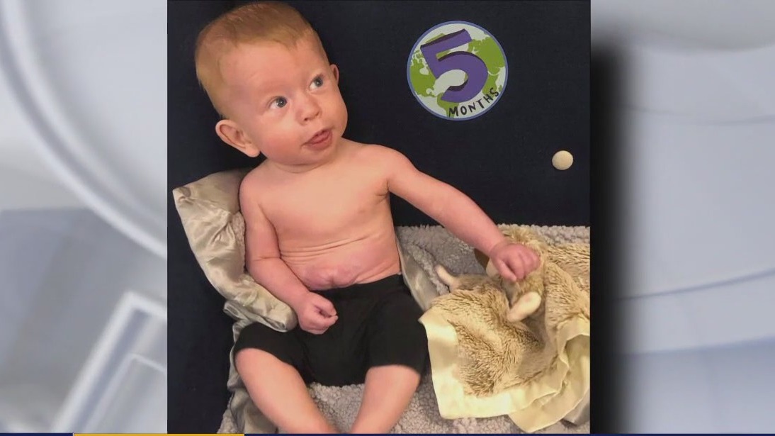 Baby born with organs outside body is thriving