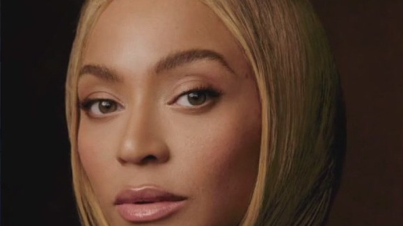Beyonc? opens up about Psoriasis battle