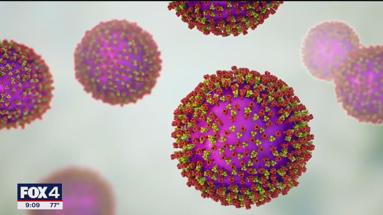 1st measles case confirmed in Dallas County