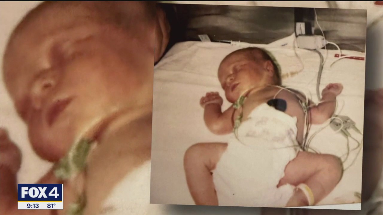 Former cancer patient now works as nurse at hospital