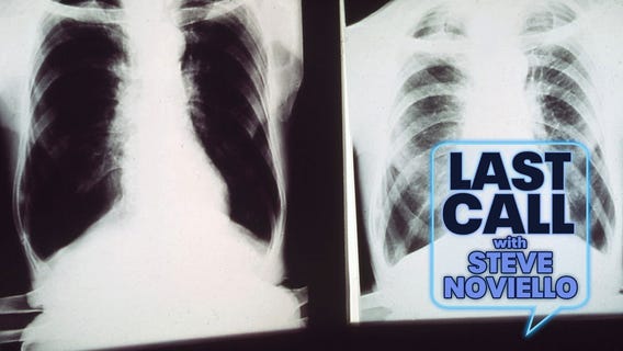 Would you sell your ribs for $50,000?