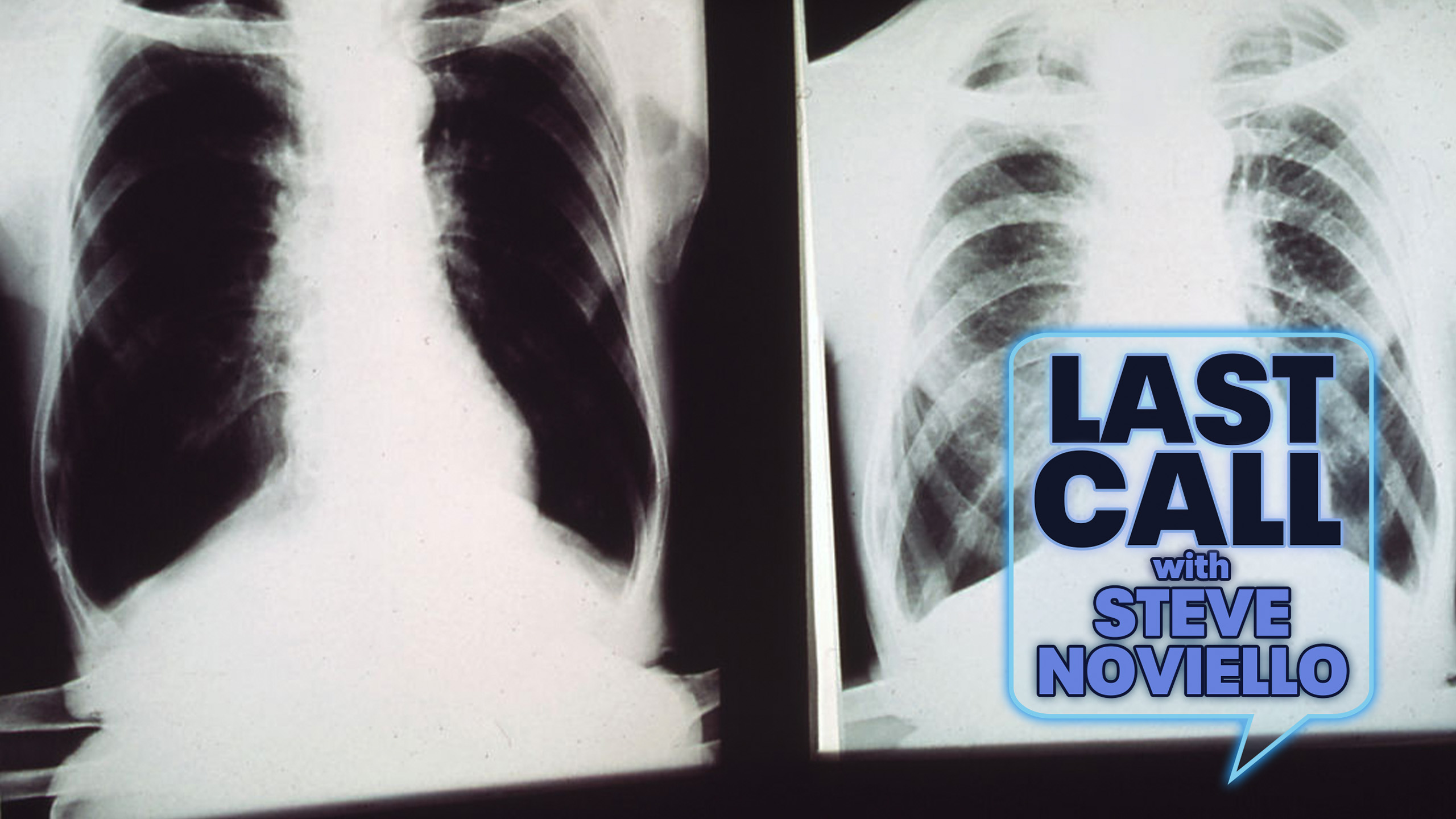 Would you sell your ribs for $50,000?