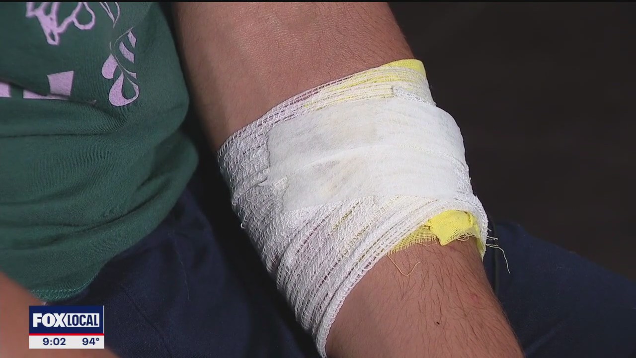 Random stabbing in Frisco suburb leaves teen injured