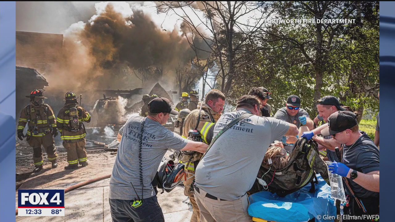 Fort Worth firefighter recovering from serious burns