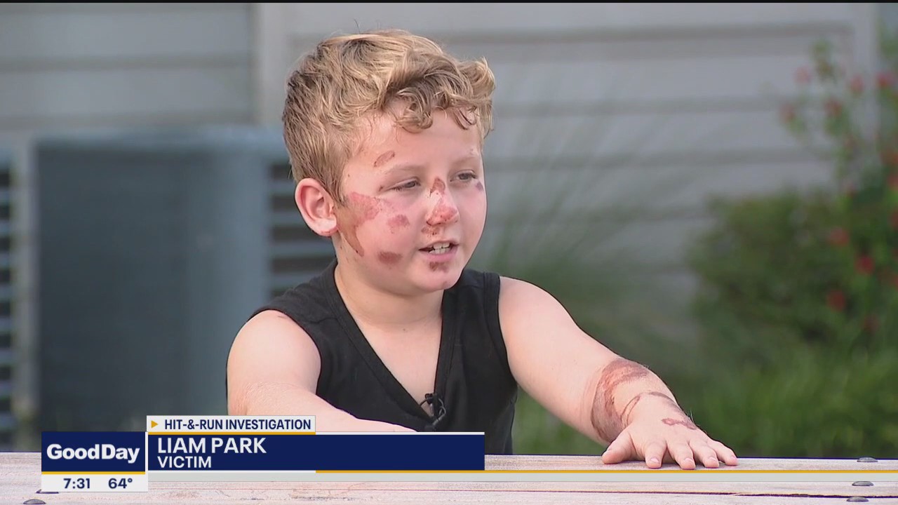 Help police find hit-and-run driver who injured 8-year-old