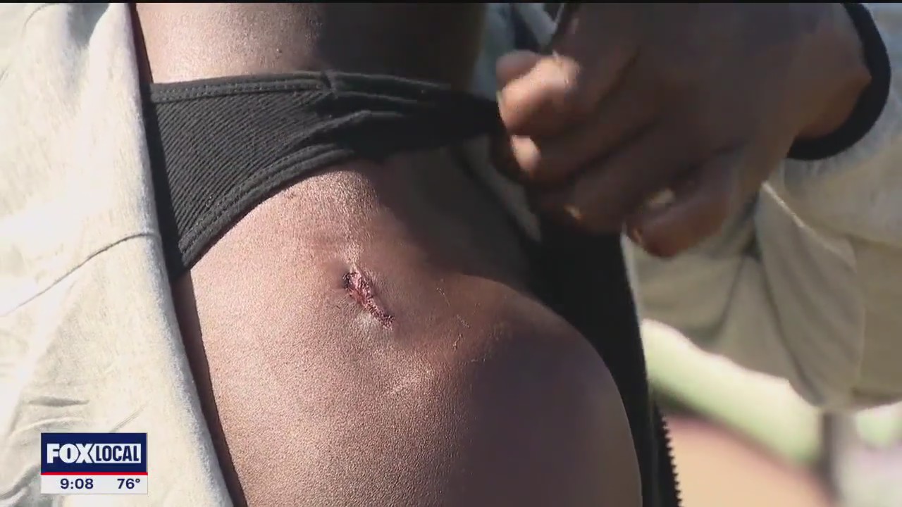 Mesquite dad shot by teens while protecting son