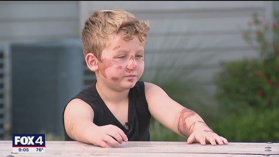 8-year-old hospitalized after Fort Worth hit-and-run