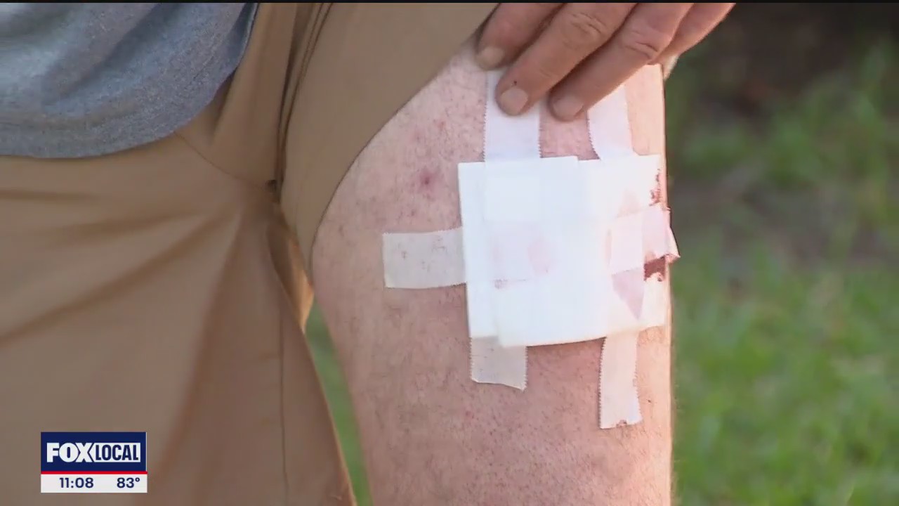 Grand Prairie PD could face legal action for shooting