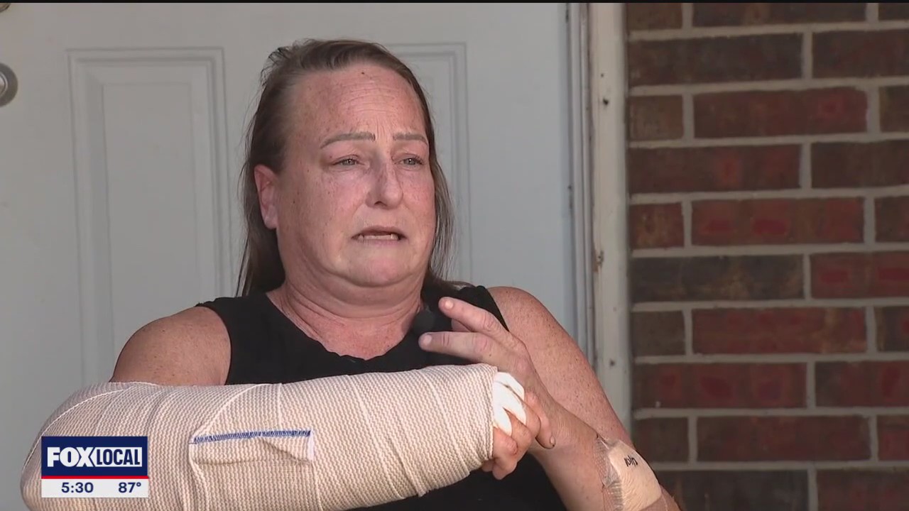 Dog attack victim recovers as police search for owner