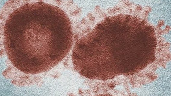CDC calling Delta Variant 'variant of concern'
