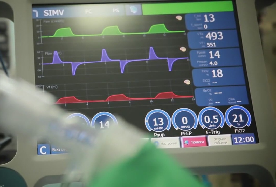 Delta variant showing grim picture with increasing number of children hospitalized