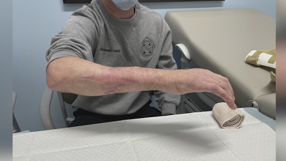 Florida firefighter and paramedic survives alligator bite