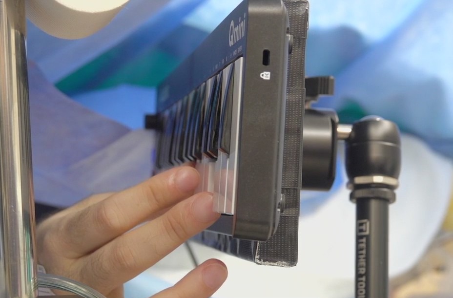 Texas musician plays piano while undergoing brain tumor surgery