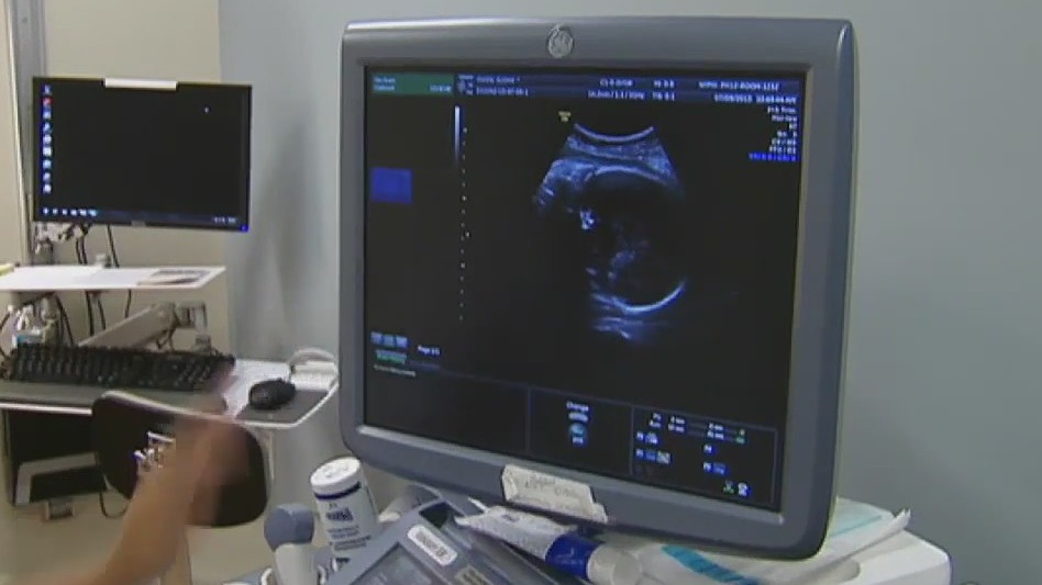 The Breakdown: SCOTUS hears abortion argument