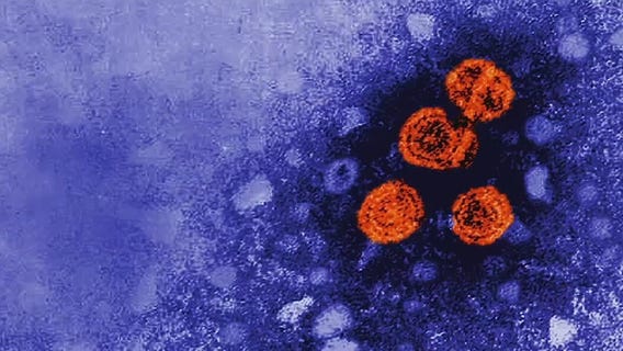 Global outbreak of pediatric hepatitis has health officials on high alert