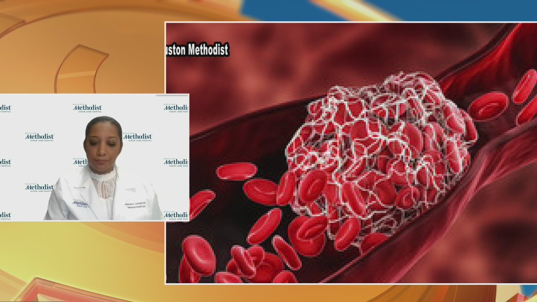 Houston Methodist Sugar Land Stroke Unit earns national recognition