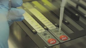 More than 2.5 million vaccine doses ordered to combat monkeypox outbreak