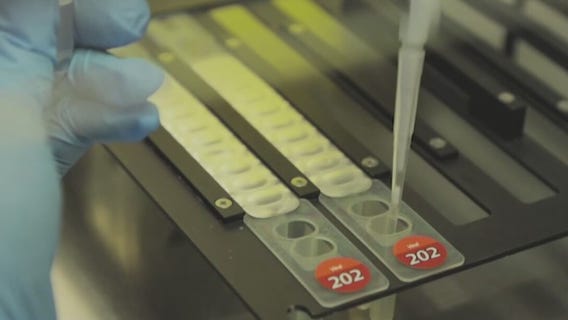 More than 2.5 million vaccine doses ordered to combat monkeypox outbreak