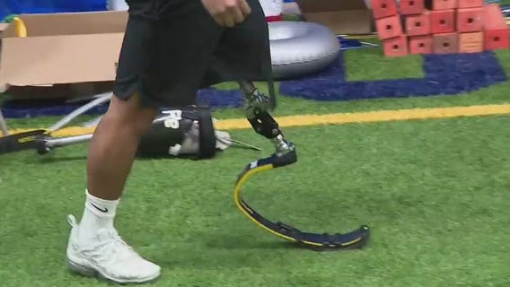 Houston teen gifted running prosthetic leg to continue soccer aspirations