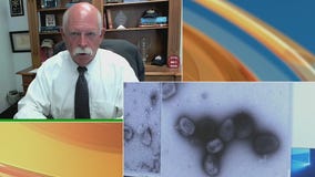 Houston Health Authority on Monkeypox risk, vaccines and tests