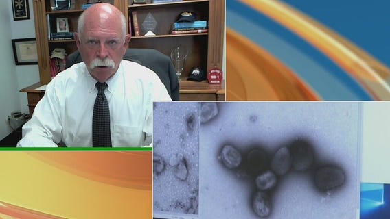 Houston Health Authority on Monkeypox risk, vaccines and tests