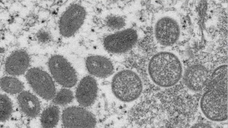 Fight against Monkeypox in schools continues