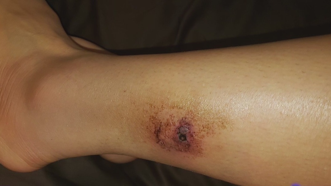 Greenleaf actress speaks out after being attacked by a dog