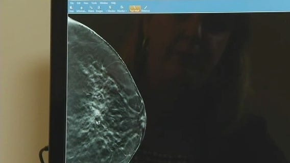 What are the sneaky signs of breast cancer?