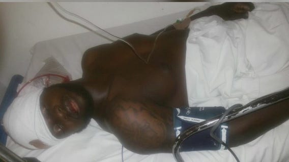 Former tennis star overcomes traumatic brain injury after told he wouldn't walk, talk again