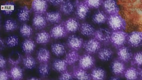 Contagious stomach bug spreading across the country