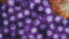 Stomach flu cases on the rise