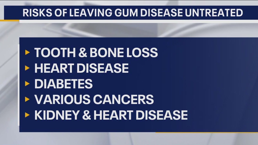 LANAP treatment for gum disease
