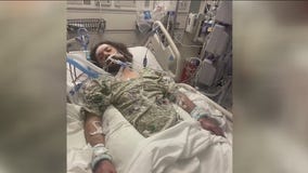 Houston man's limbs amputated after flea bite