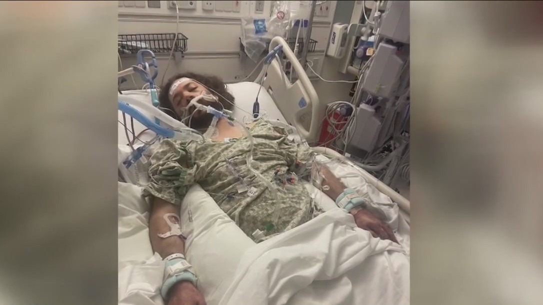 Houston man's limbs amputated after flea bite